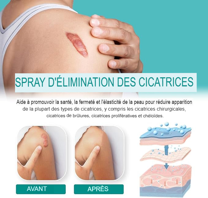 Spray Anti-Cicatrices  Médicale