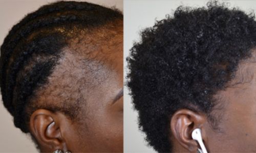 Be Bodywise™ – Le Sérum Repousse Cheveux