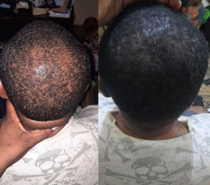 Be Bodywise™ – Le Sérum Repousse Cheveux