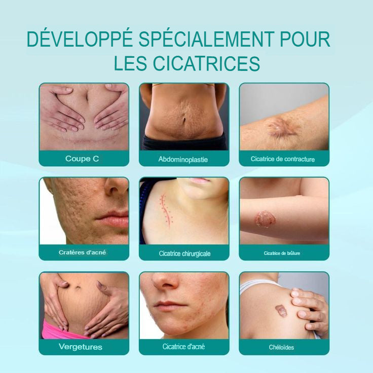 Spray Anti-Cicatrices  Médicale