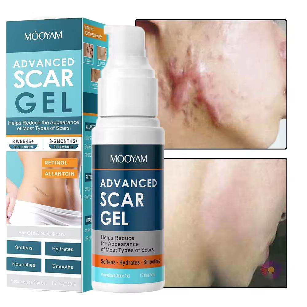 Gel Anti-Cicatrices