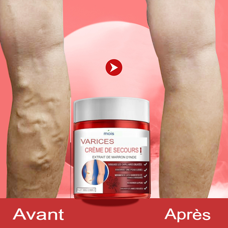 Crème contre les Varices