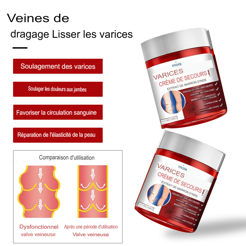 Crème contre les Varices