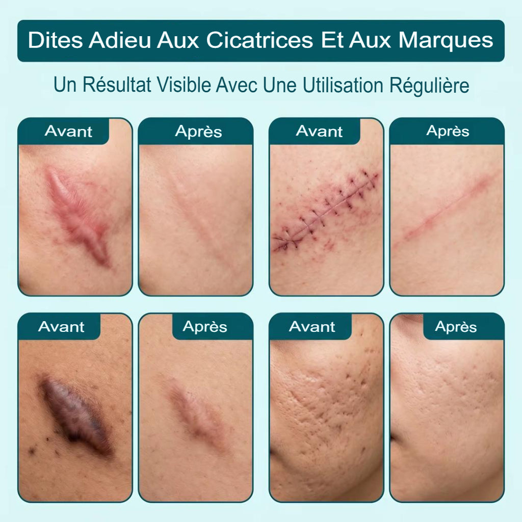Gel Anti-Cicatrices